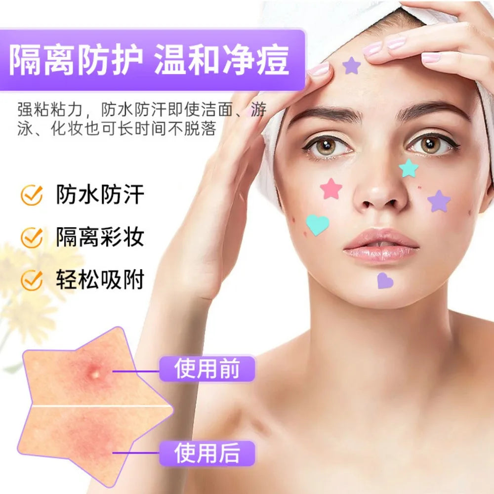 Colorful Star Pimple Patch Acne Colorful Invisible Acne Removal Skin Care Stickers Concealer Face Spot Beauty Skin Care Tools